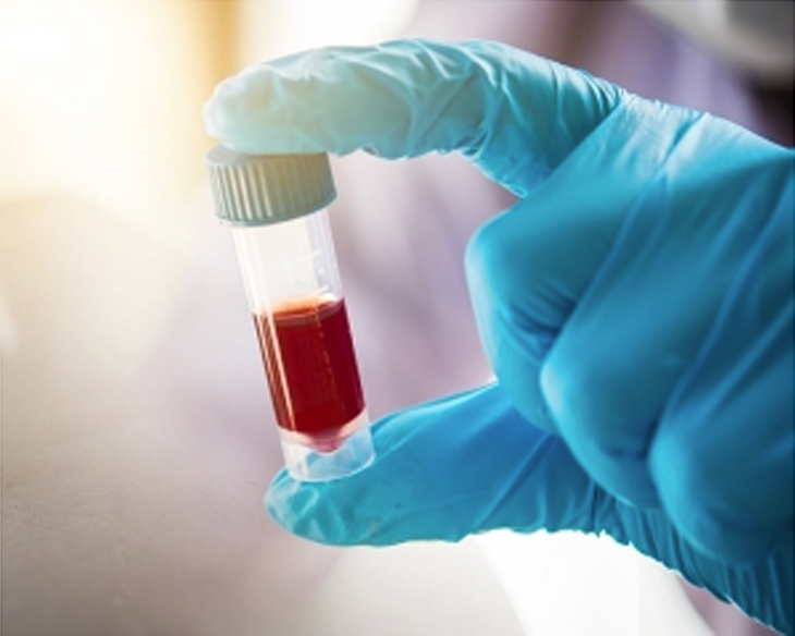 Testing Tool Can Quickly Distinguish Between Viral and Bacterial Infections Duke Health